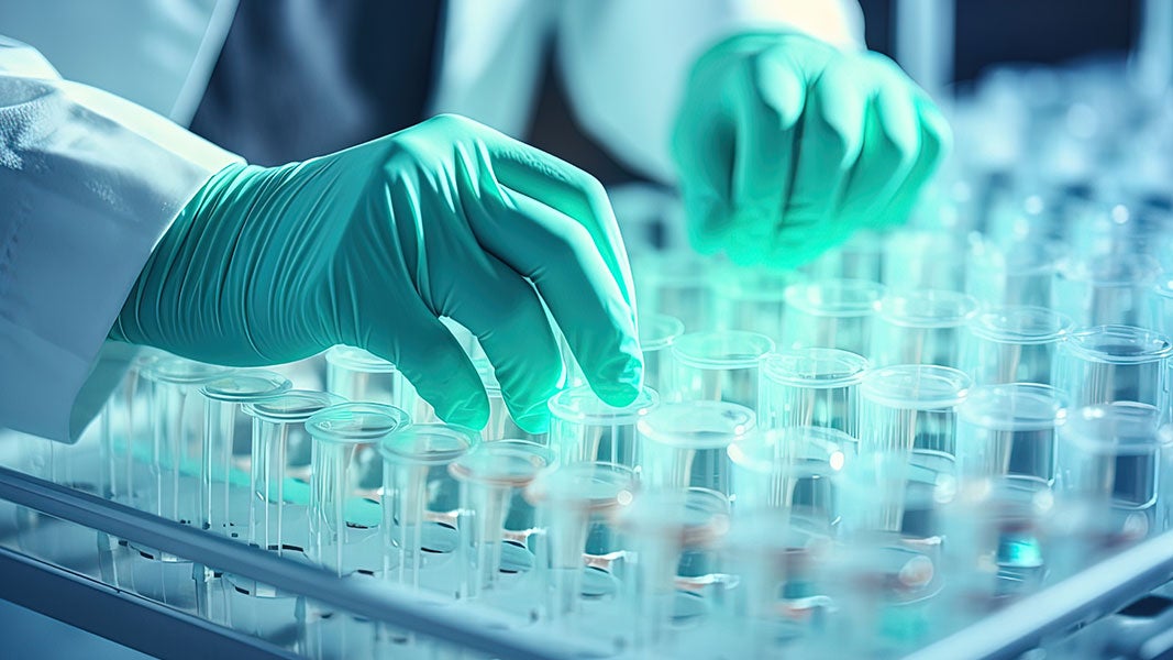 Lead Optimization in Drug Discovery